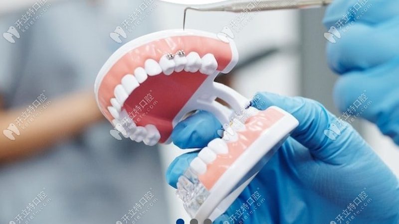 成都洗牙团购预约，轻松享受口腔健康**
