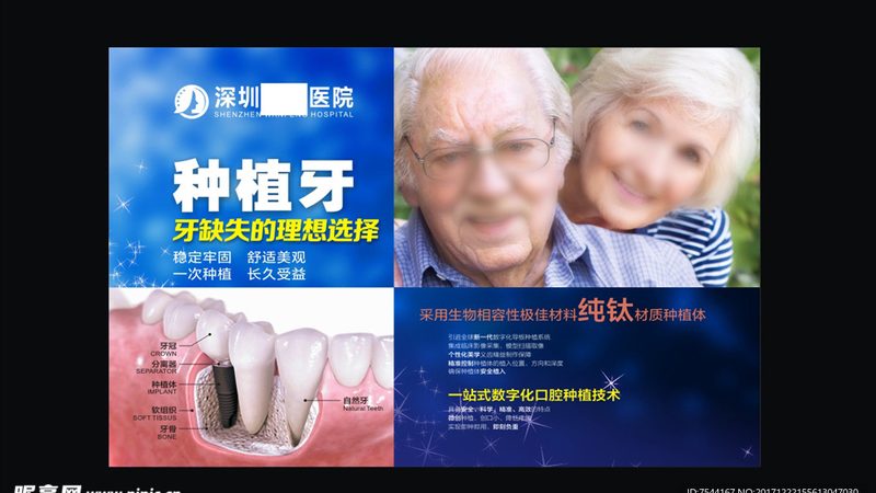 根管治疗牙套与嵌体：价格背后的区别解析**