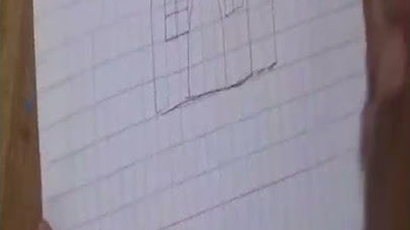 隐形矫正器批发价格背后的考量因素**